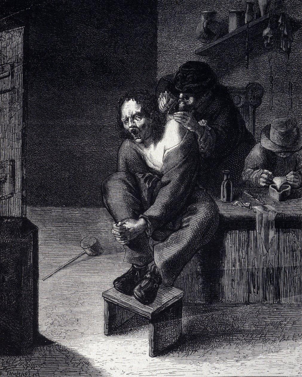 Operacja chirurgiczna Grawerowanie według obrazu Adriaena Brouwera (zrobił 1608) XVII wiek autorstwa Adriaen (after) Brouwer