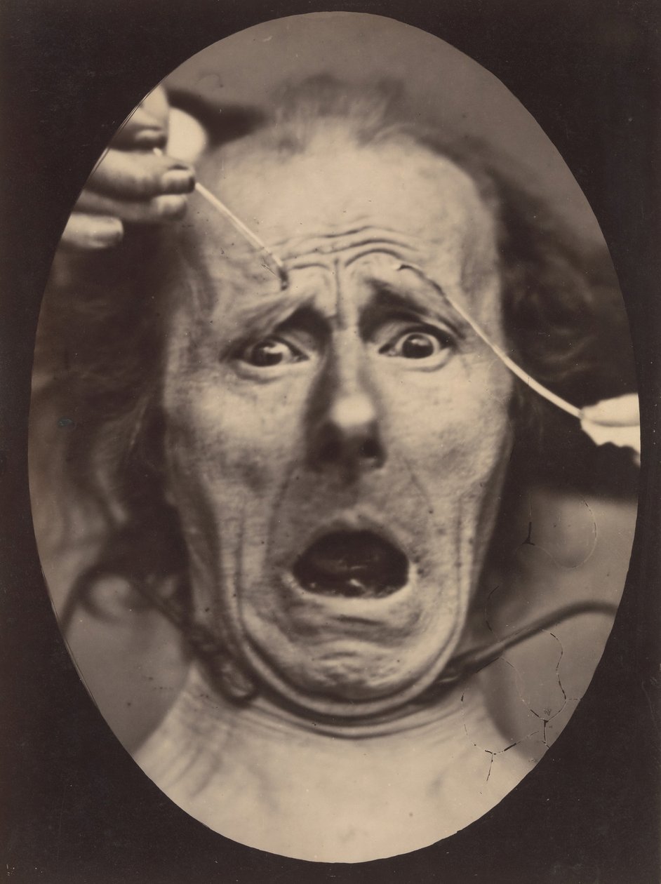 Elektrofizjologia, ryc. 64, 1854-56, wydrukowany 1862. autorstwa Adrien Alban Tournachon