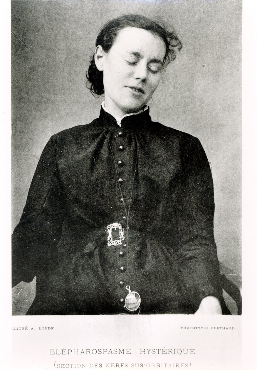 Mimowolny kurcz powiek, z „Nouvelle Iconographie de la Salpetriere” profesora Jeana Martina Charcota (1825-93) opublikowanej w Paryżu, 1889 autorstwa Albert Londe