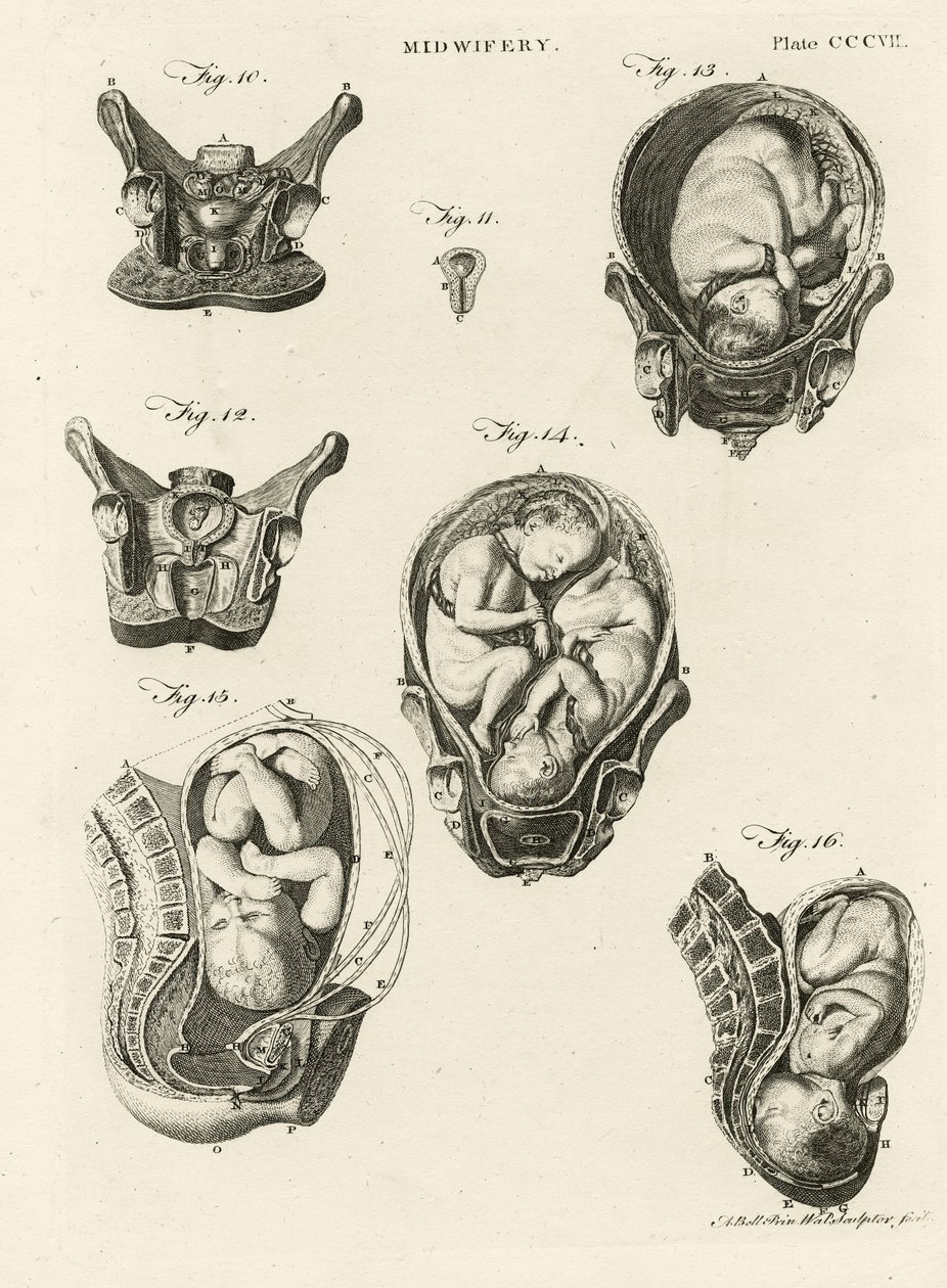 Położna, ilustracja z „Encyklopedii Britannica”, wydanej w Edynburgu, 1798 (miedzioryt) autorstwa Alexander Bell