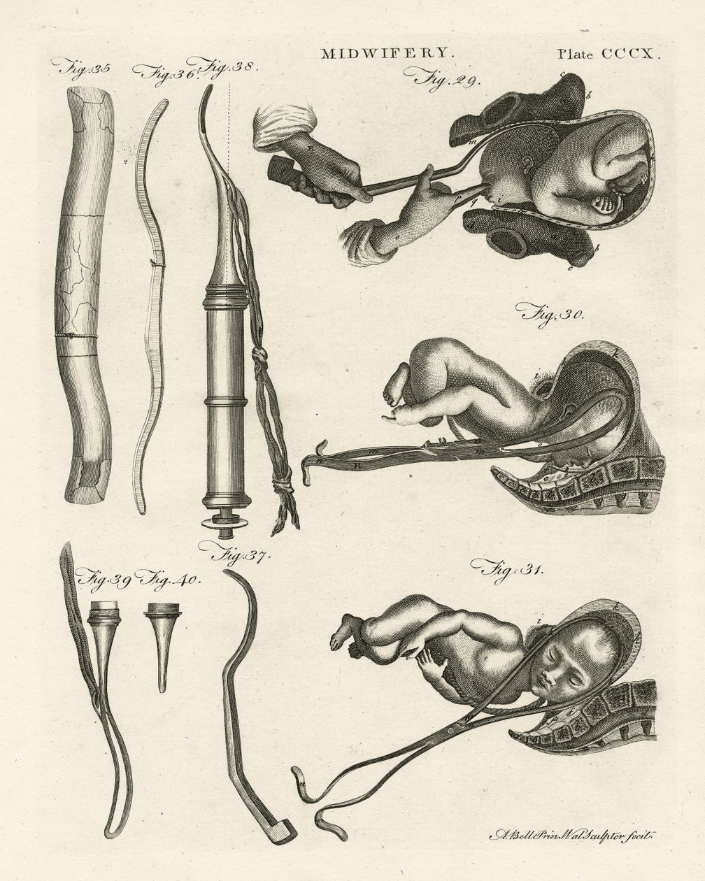 Położna, ilustracja z „Encyklopedii Britannica”, wydanej w Edynburgu, 1798 (miedzioryt) autorstwa Alexander Bell
