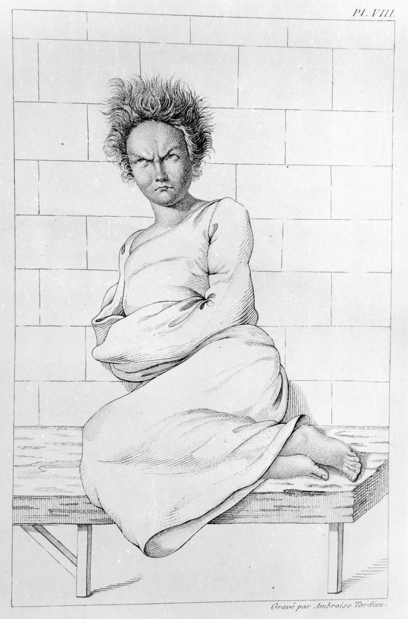 Kobieta w kaftanie bezpieczeństwa, ilustracja do „Des Maladies Mentales rozważane w ramach raportu medycznego, higienicznego i medyczno-prawnego”, Etienne Esquirol (1772-1840), 1838 autorstwa Ambroise Tardieu