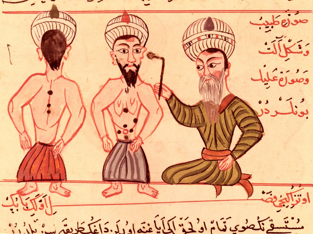 Pani Sup Turc 693 fol.35 Operacja kauteryzacji, 1466 autorstwa Charaf ed Din