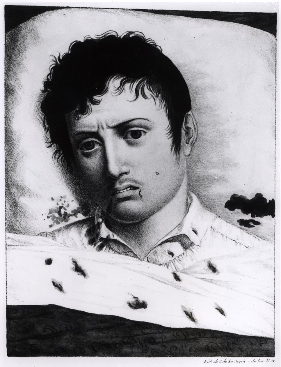 Obserwacja żółtej febry, c.1819 autorstwa Charles Lasteyrie du Saillant