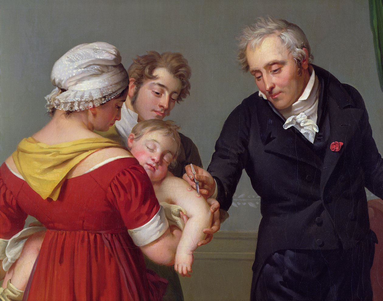 Baron Jean Louis Alibert (1768-1837) przeprowadza szczepienie przeciwko ospie w zamku Liancourt, ok. 1930 r. 1820 (szczegóły) autorstwa Constant Joseph Desbordes