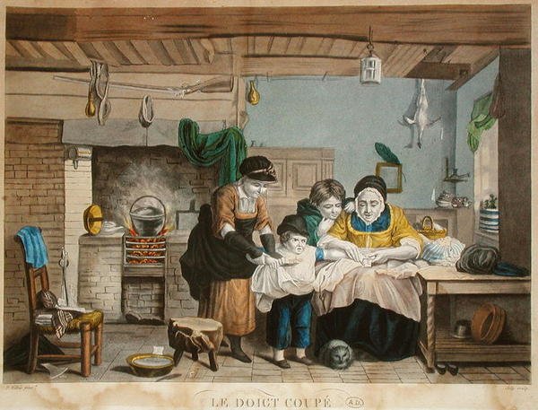 Cięty palec, grawer Joly, ok.1830-40 (kolorowy grawerunek) autorstwa David (after) Wilkie