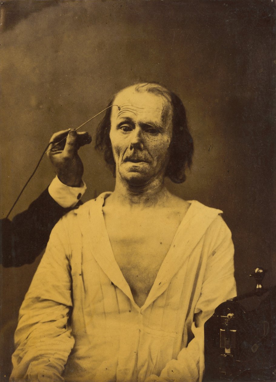 Zrelaksowana twarz po lewej, Głęboka uwaga po prawej, 1854-1856, wydruk 1862. autorstwa Duchenne de Boulogne