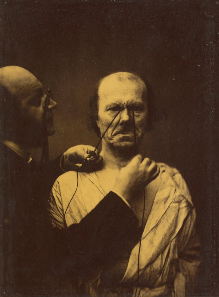 Agresja, niegodziwość, 1854-1856, druk 1862. autorstwa Duchenne de Boulogne
