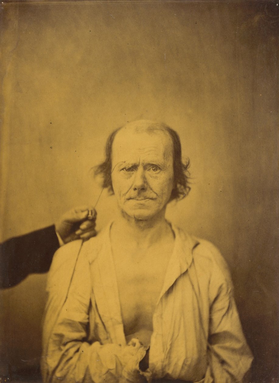 Uwaga po lewej, Odbicie po prawej, 1854-1856, druk 1862. autorstwa Duchenne de Boulogne