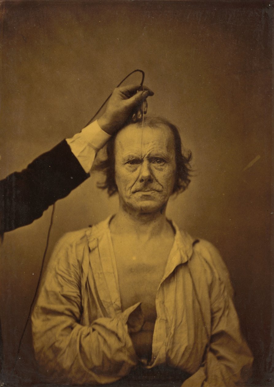 Uwaga lewa, dotkliwość, agresja prawa, 1854-1856, druk 1862. autorstwa Duchenne de Boulogne