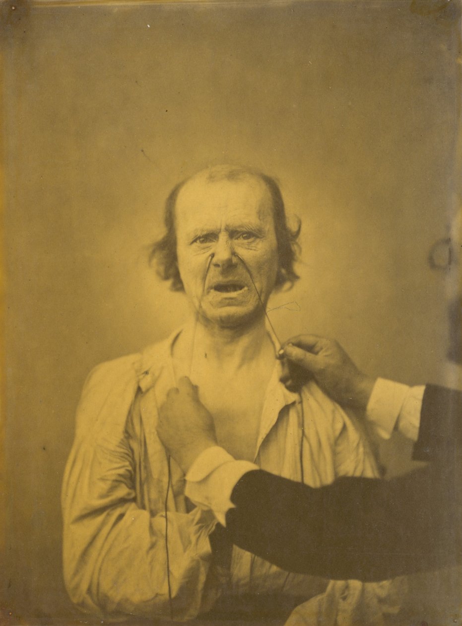Niezadowolenie, zły humor, 1854-1856, druk 1862. autorstwa Duchenne de Boulogne