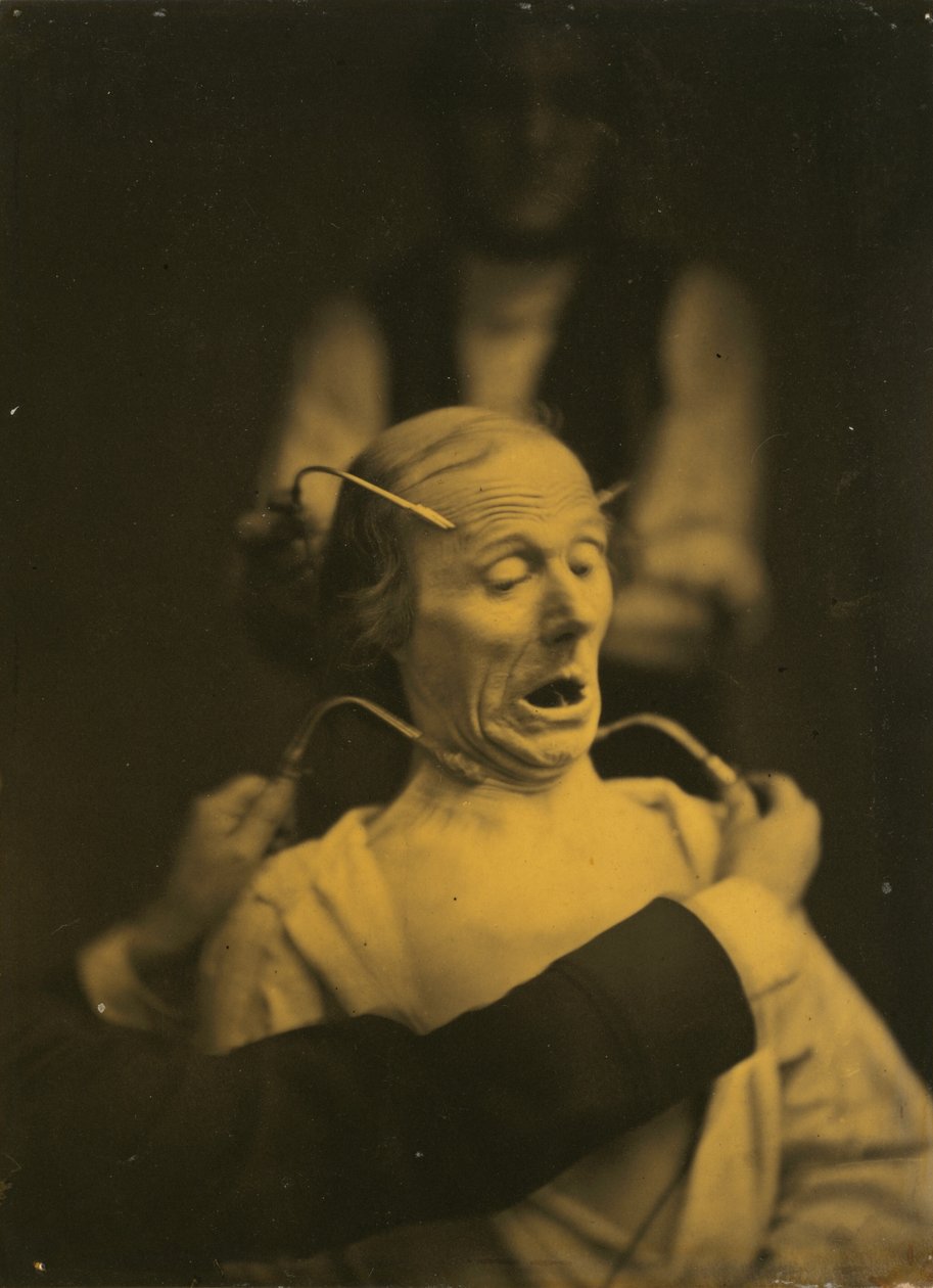 Wyrażenie terroru, 1854-1856, druk 1862. autorstwa Duchenne de Boulogne
