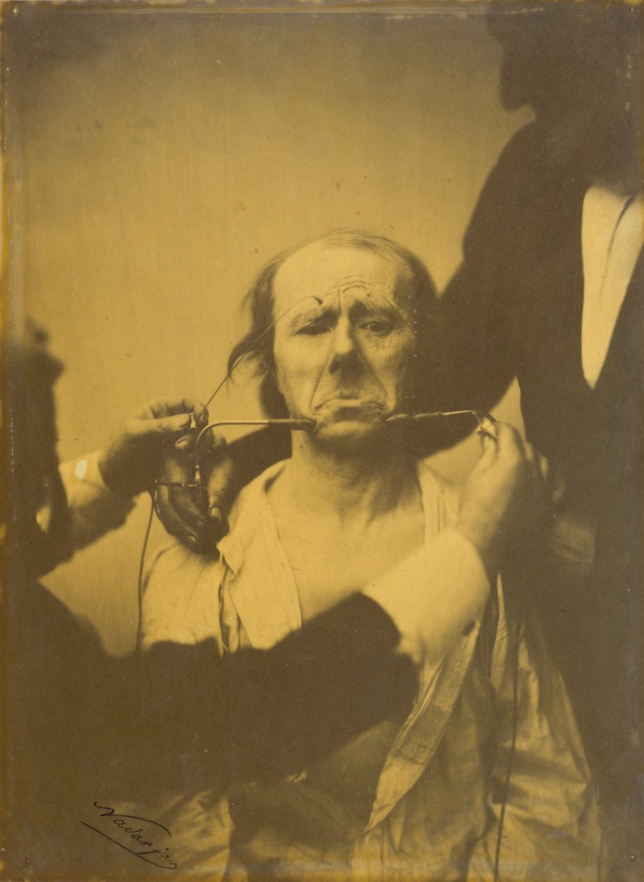 Ból i rozpacz, 1854-1856, druk 1862. autorstwa Duchenne de Boulogne