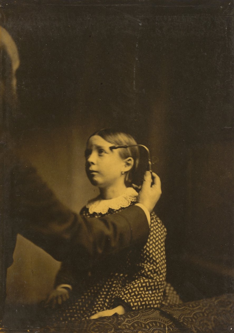 Bolesne wspomnienia, 1854-1856, druk 1862. autorstwa Duchenne de Boulogne