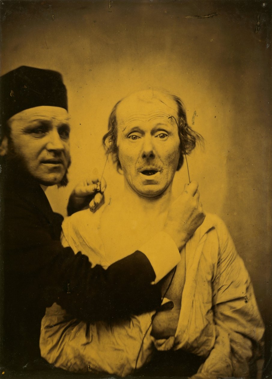 Niespodzianka, 1854-1855, druk 1862. autorstwa Duchenne de Boulogne