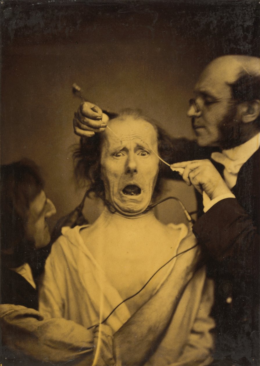 Terror zmieszany z bólem, tortury, 1854-1856, druk 1862. autorstwa Duchenne de Boulogne