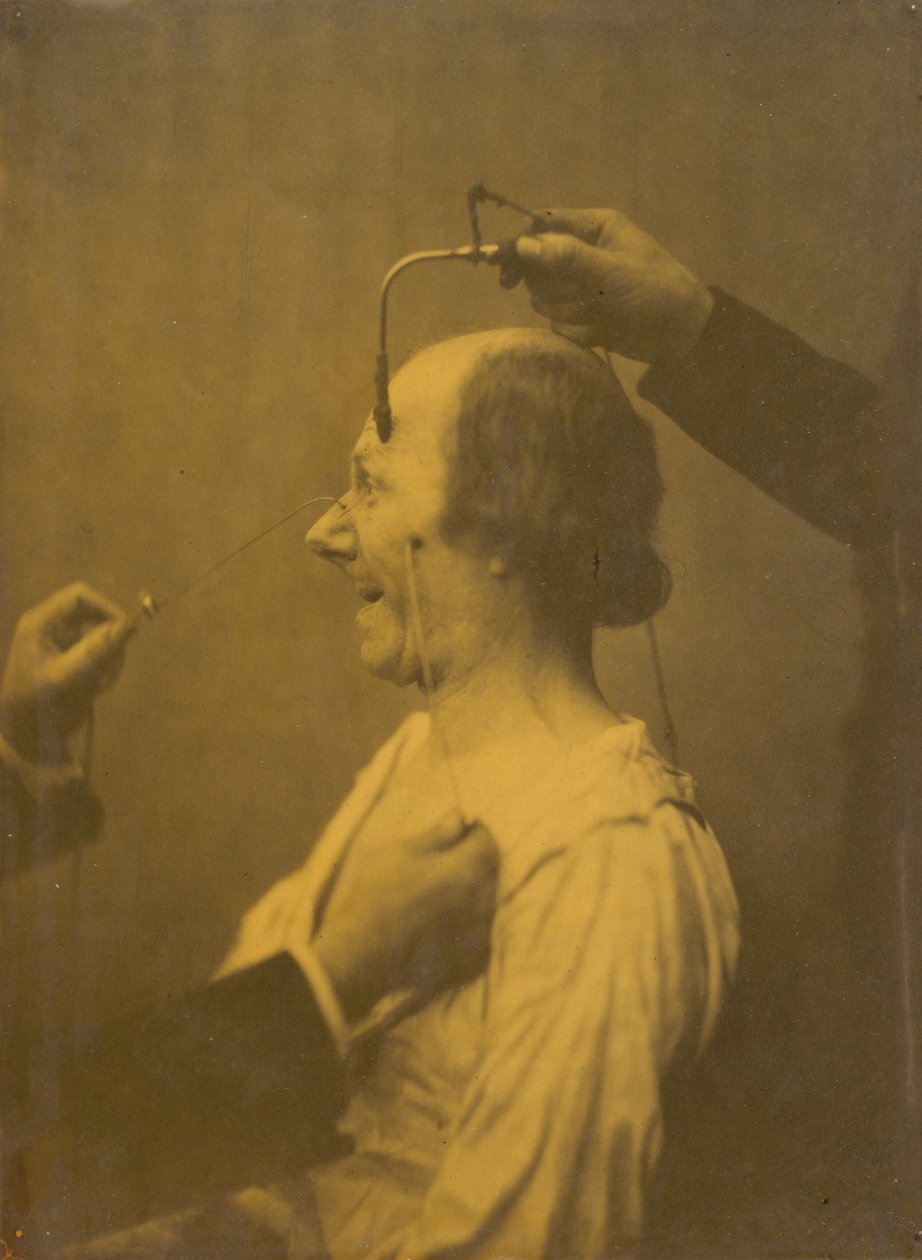 Uwagę przyciąga przedmiot prowokujący lubieżne idee i pragnienia, 1854-1856. autorstwa Duchenne de Boulogne