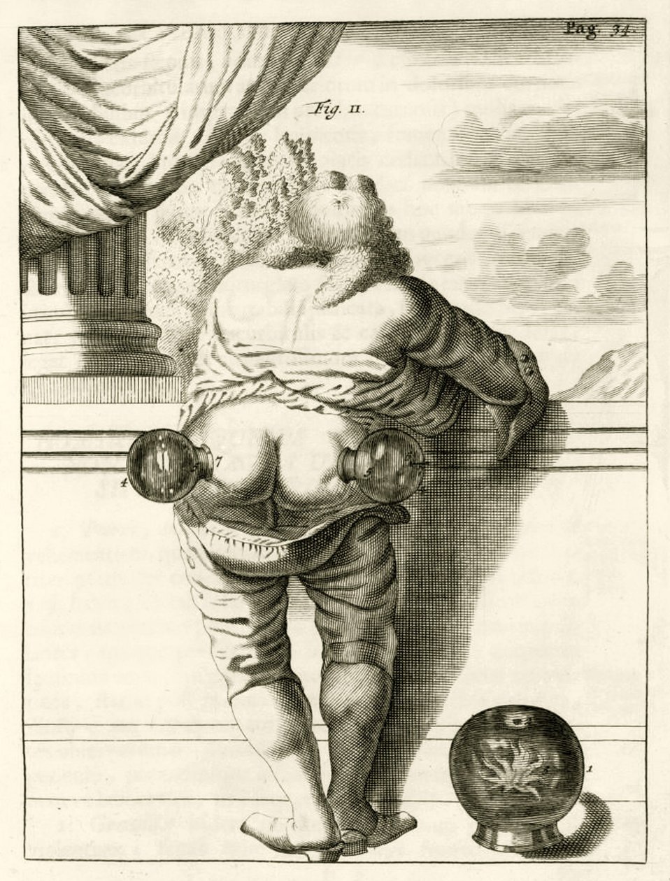 Przykład bańki, z The Practice of Medicine Frederika Dekkersa, 1694 autorstwa Dutch School