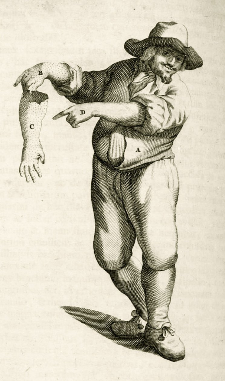 Usuwanie martwego naskórka z krostami, z Ćwiczeń praktycznych z metod medycznych Frederika Dekkersa, 1694 autorstwa Dutch School