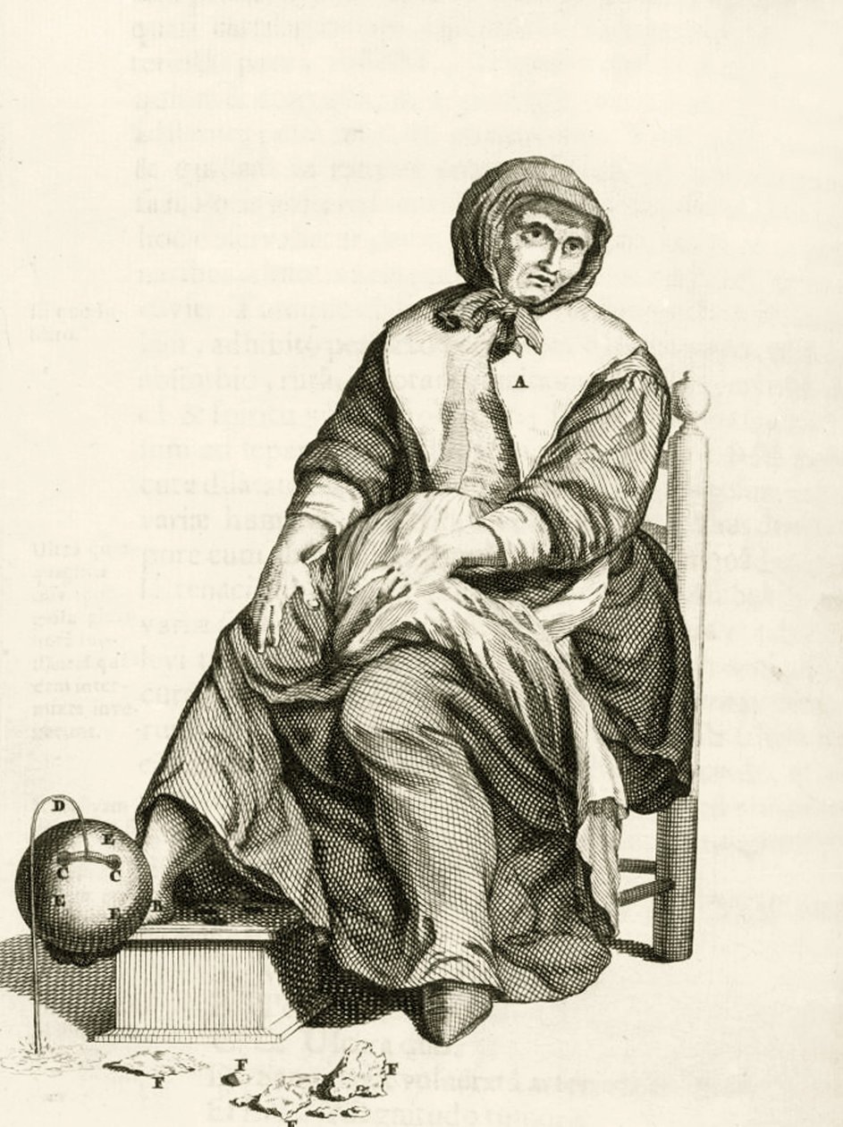 Korzystanie z mechanicznej pijawki, z Ćwiczeń praktycznych dotyczących metody uzdrawiania autorstwa Frederika Dekkersa, 1694 autorstwa Dutch School