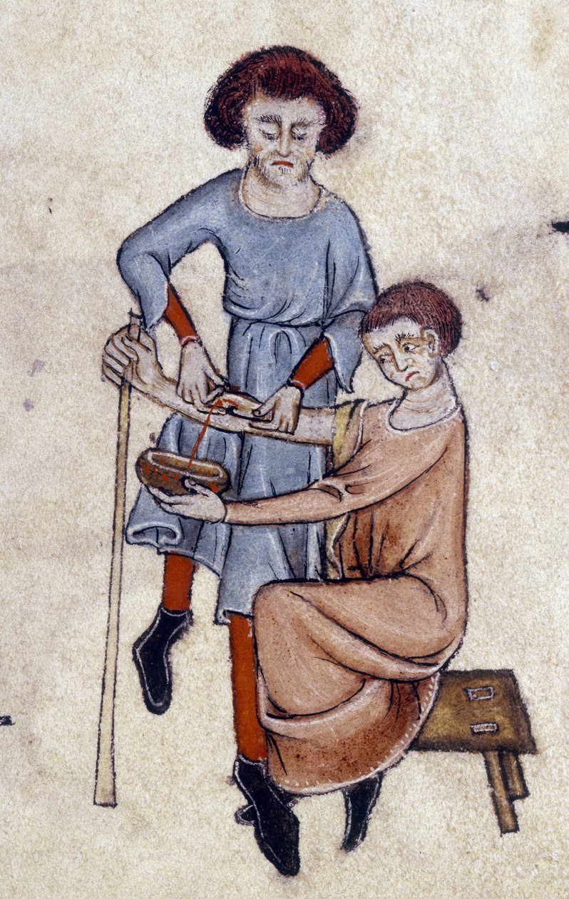 Upuszczanie krwi, z psałterza Luttrella, ok. 1325-35 (welum) autorstwa English School