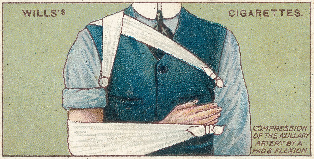 Ucisk tętnicy pachowej za pomocą podkładki i zgięcia, nr 41 z serii kart z papierosami Willsa, 1913 autorstwa English School