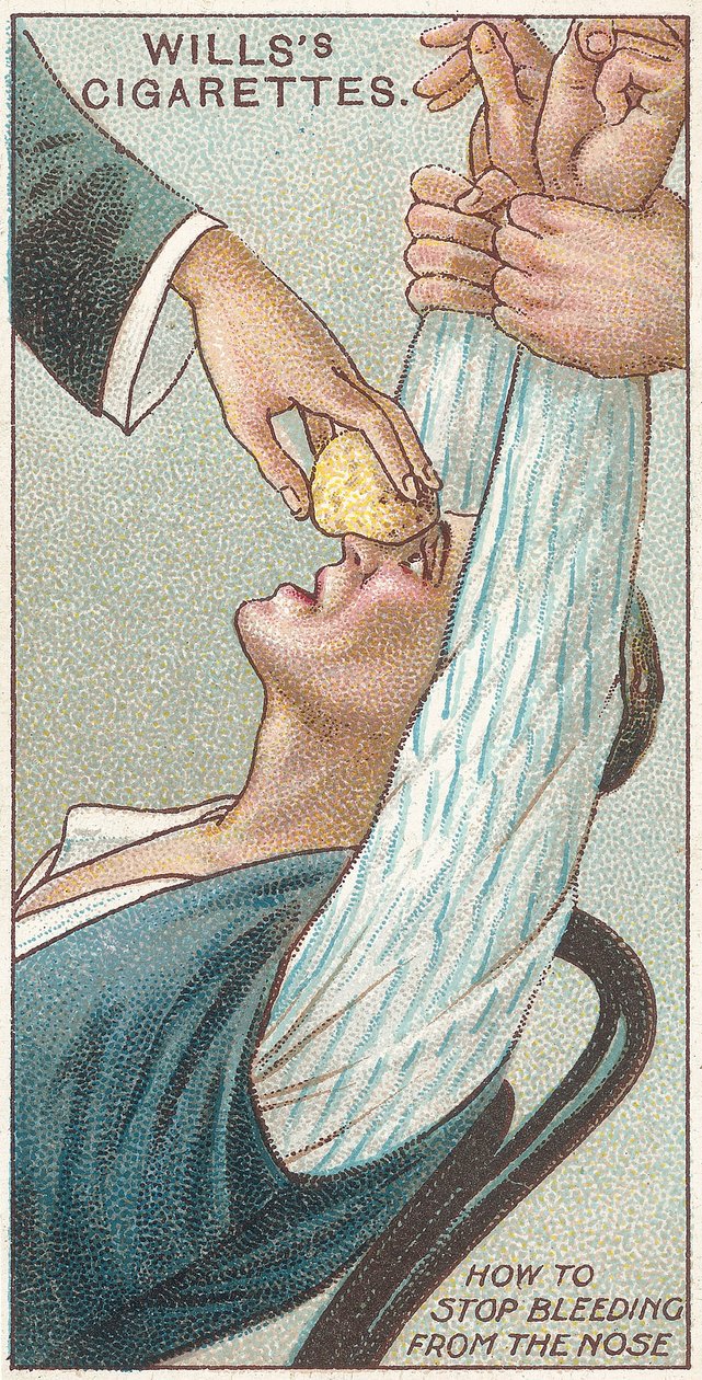 Jak zatrzymać krwawienie z nosa, nr 31 z serii kart „Pierwsza pomoc” Willss Cigarettes, 1913 autorstwa English School