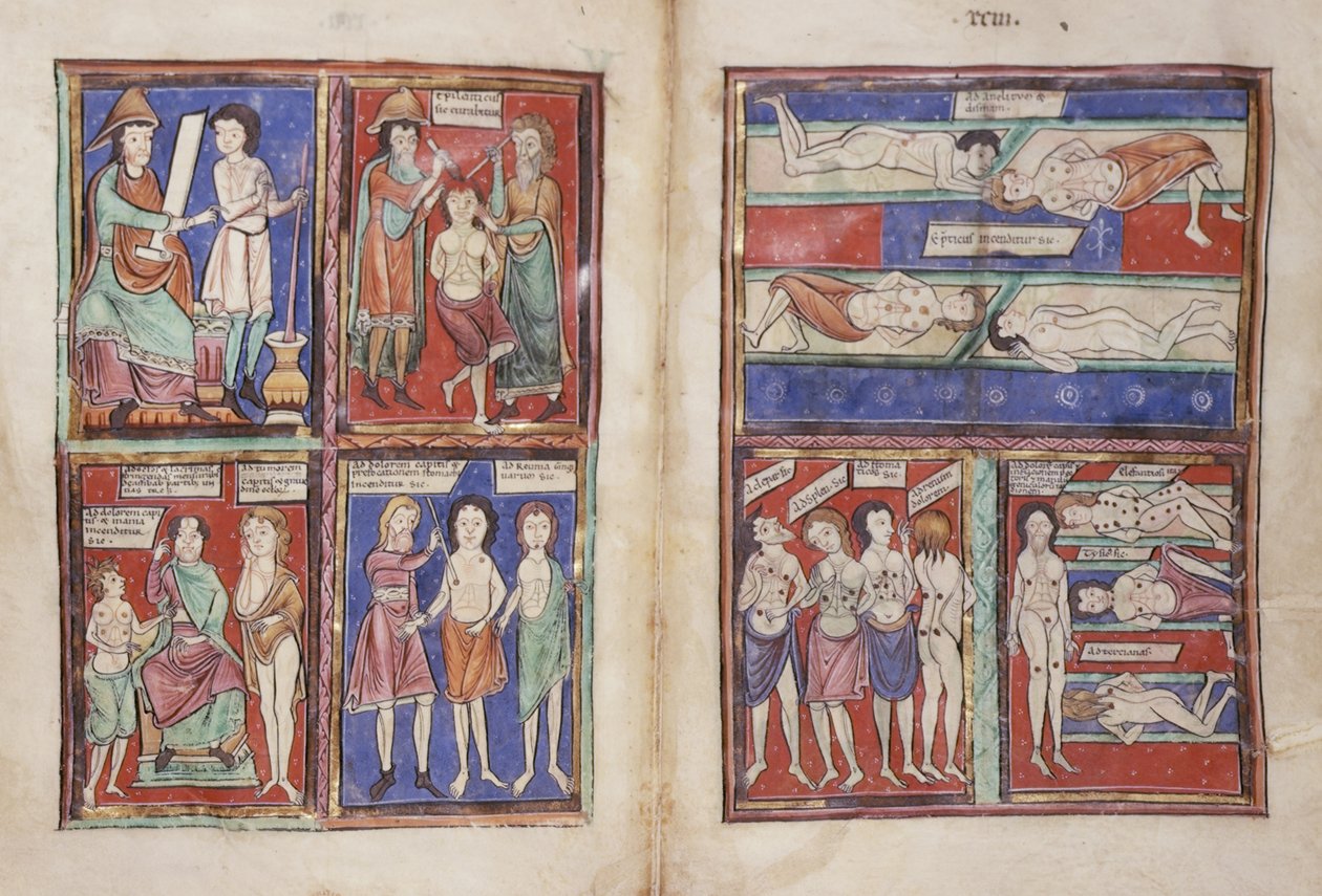 Sloane 1975 fol.91v-92 Sceny medyczne autorstwa English School