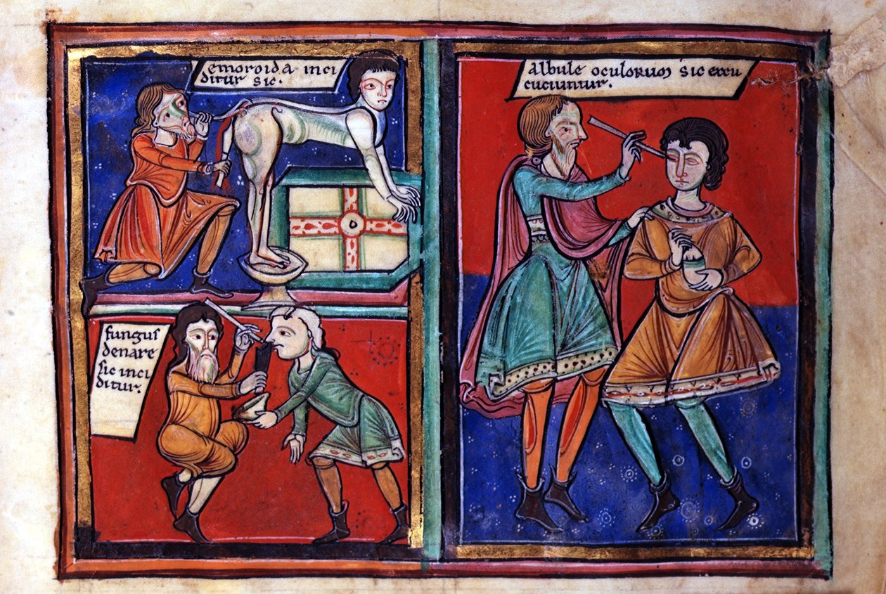 Sloane Ms 1975 fol.93 Operacje medyczne autorstwa English School