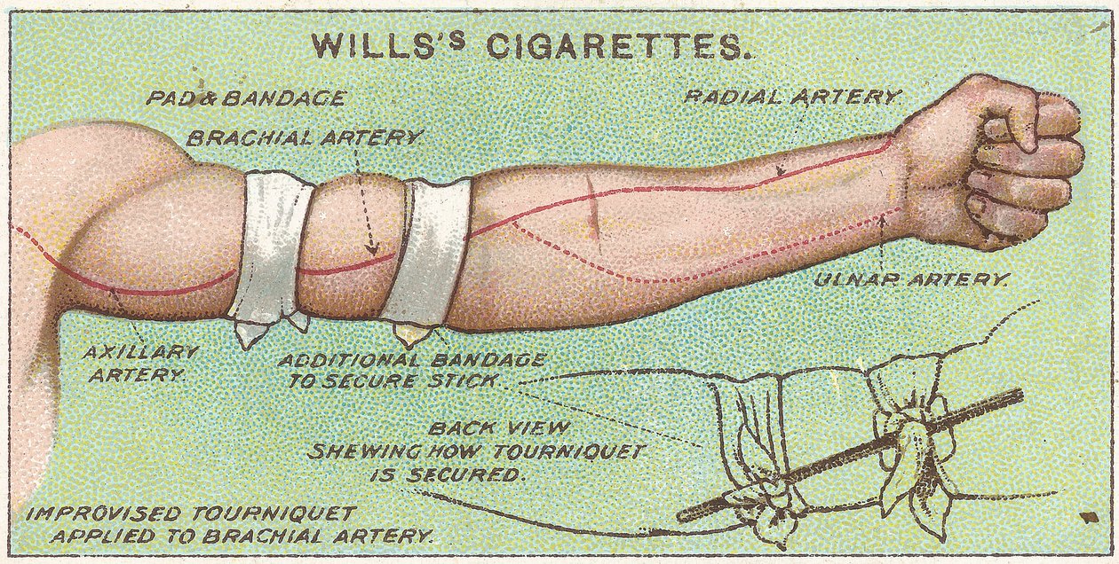Opaska uciskowa nr 11 z serii kart Willss Cigarettes z serii Pierwsza pomoc, 1913 r autorstwa English School