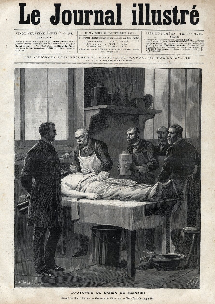 Sekcja zwłok barona Jacquesa de Reinacha (1840-1892) w 1892 r. - rycina Meaulle w „The Illustrous Journal” z 1892 r. autorstwa Fortune Louis Meaulle
