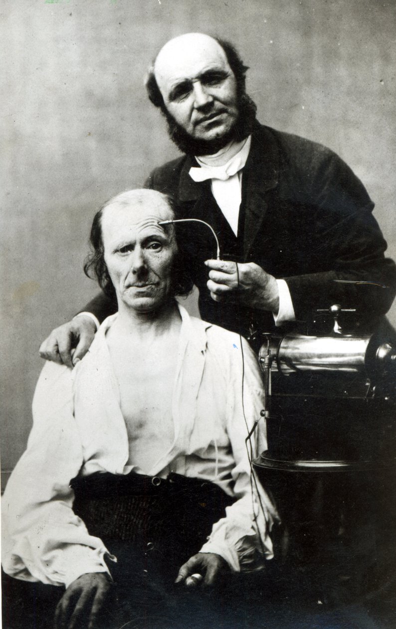 Duchenne de Boulogne z pacjentem-ofiarą, 1862 autorstwa French Photographer