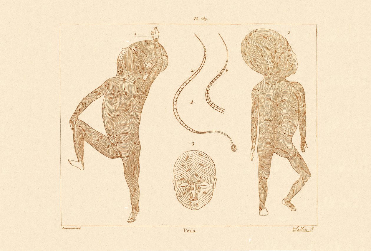 Włosy na ciele, 1833-39 autorstwa French School
