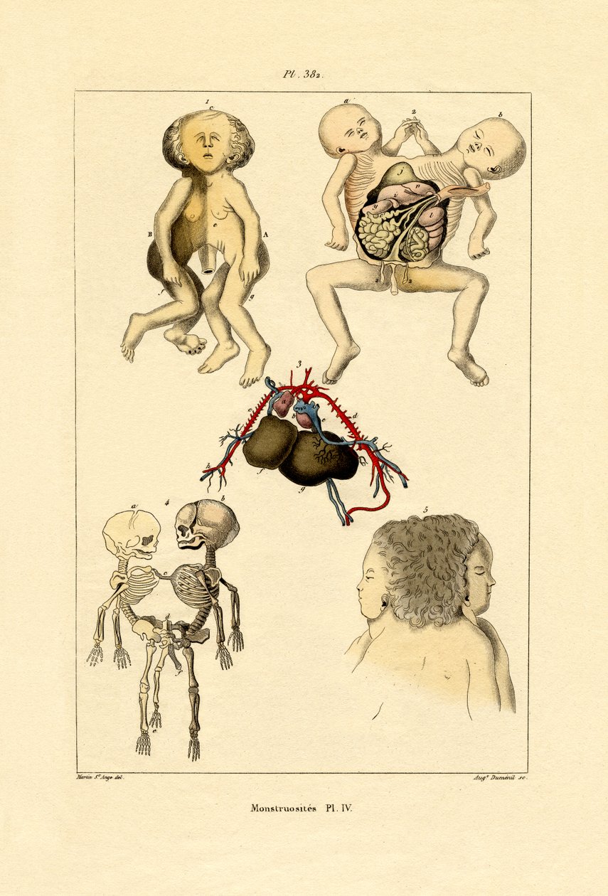 Wybryk, 1833-39 autorstwa French School