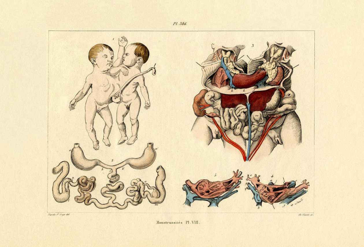 Wybryk, 1833-39 autorstwa French School