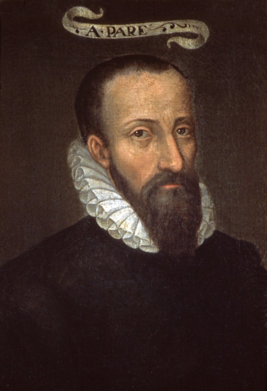 Ambroise Pare. XVI wiek (malarstwo) autorstwa French School