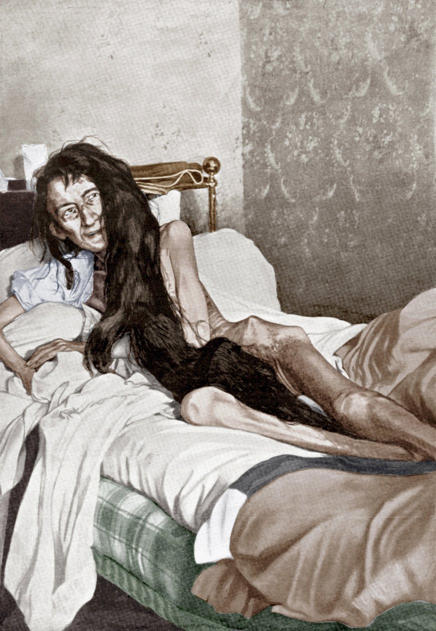 Blanche Monnier w szpitalu, Poitiers, czerwiec 1901 (druk) autorstwa French School