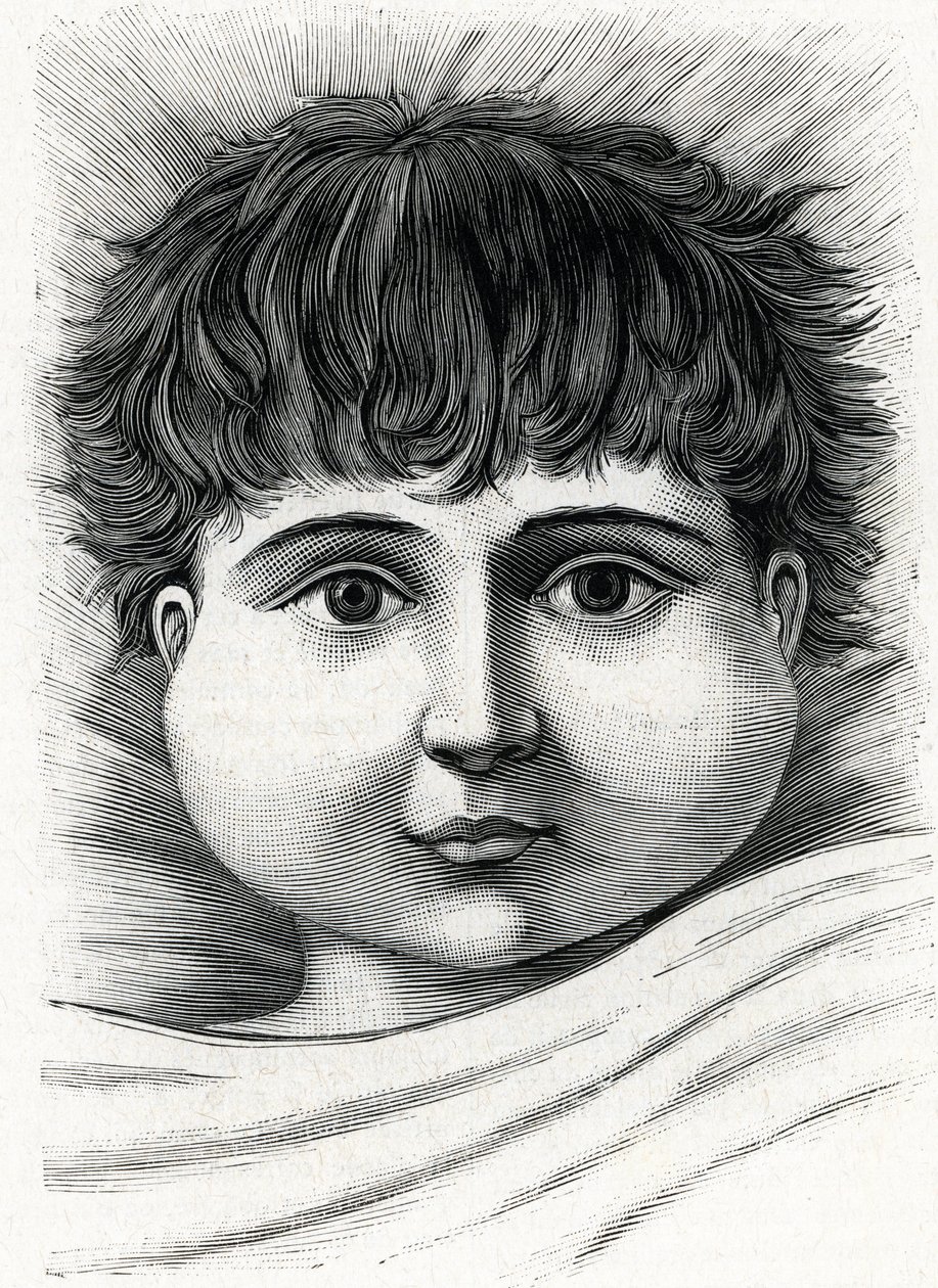 Dziecko z chorobą świnki (rycina) 1888 autorstwa French School