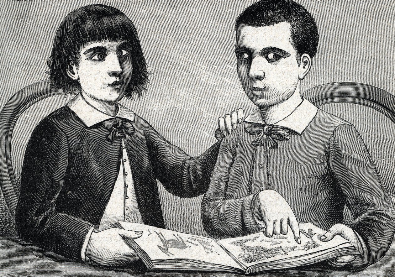 Dzieci ze zbieżnym i rozbieżnym zezem lub zezami (rycina) 1888 autorstwa French School