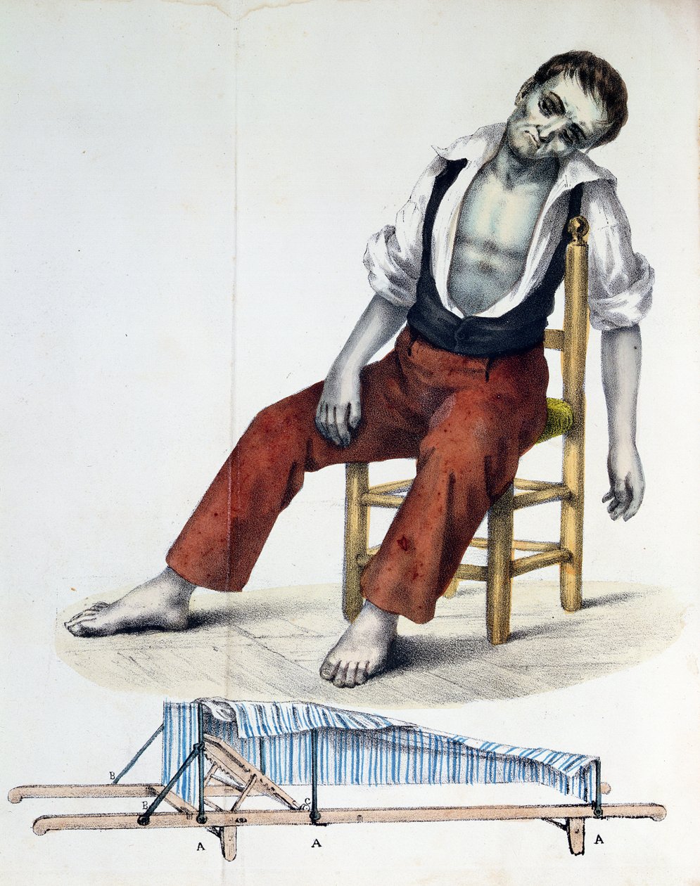 Cholera Morbus, z Relation, History, Statistics and Medicine of Cholera-Morbus autorstwa Francisco dAssis de Souza Vaz, 1833 autorstwa French School