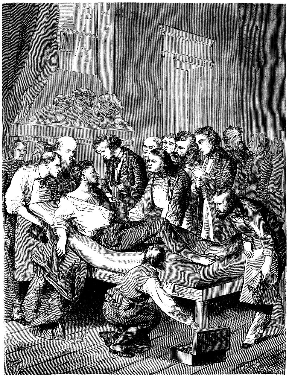 Pierwsza operacja chirurgiczna ze znieczuleniem eterem siarkowym w Boston Hospital, przeprowadzona 16 października autorstwa French School