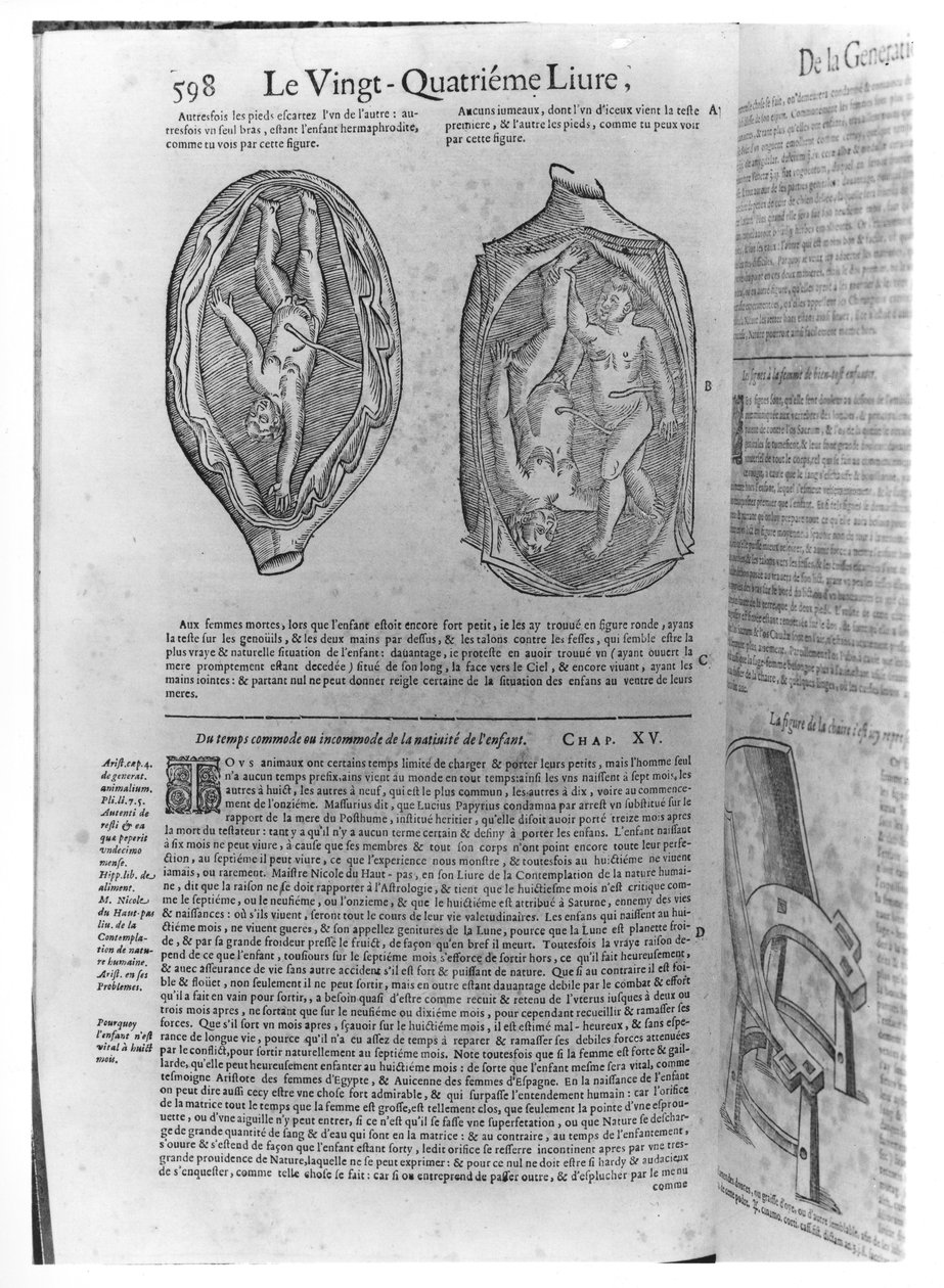 Foetus, ilustracja z Oeuvres Ambroise Pare (1509-90) wydana w Lyonie, 1641 autorstwa French School
