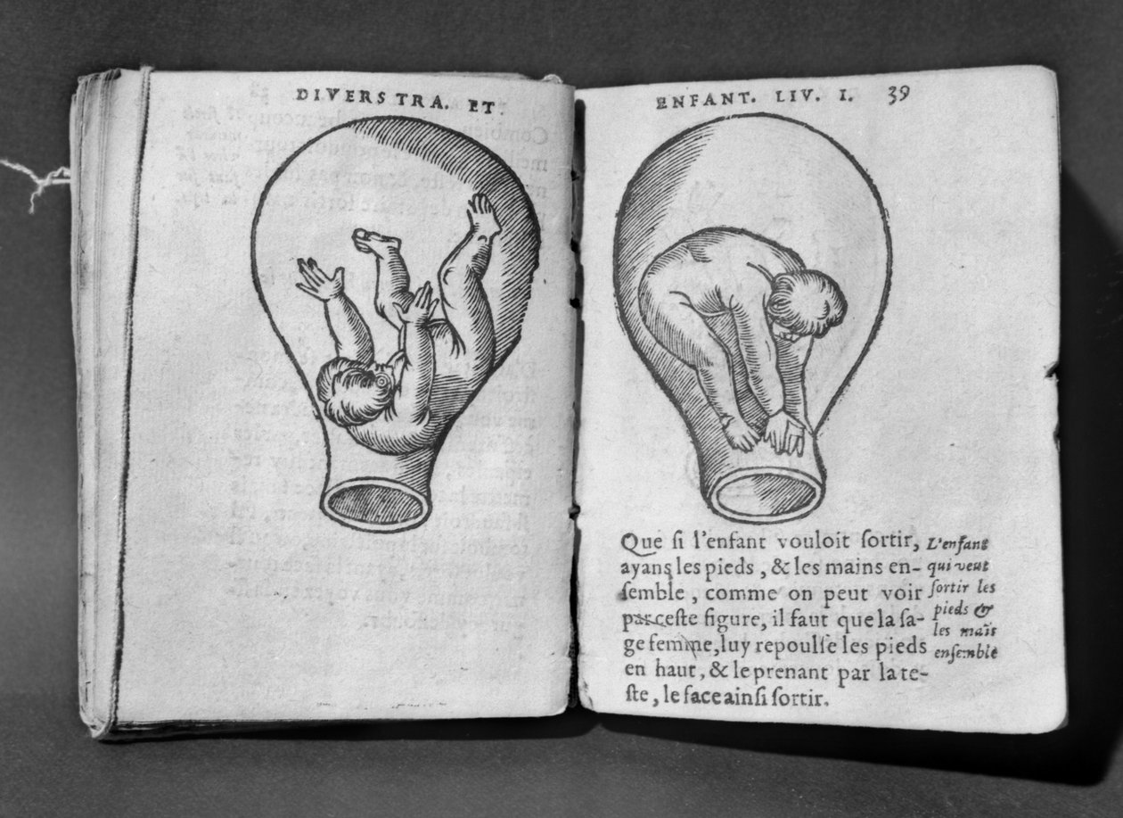 Płód w łonie matki, ilustracja z tzw. rękopisu Rodion autorstwa French School