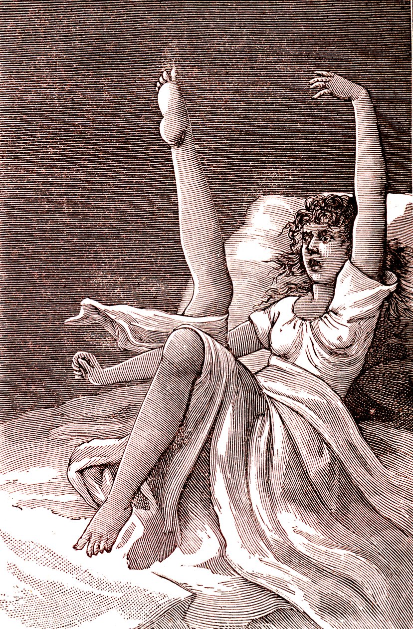 Histeria, zjawisko skrajnie psychiczne, psychozy i psychonerwice.1887 (ryc.) autorstwa French School