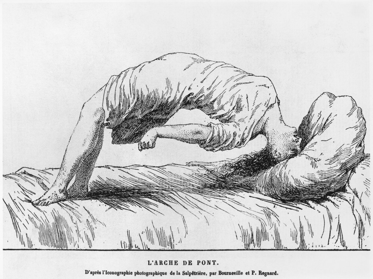 Histeria i somnambulizm, z Les Maladies Epidemiques de lEsprit Paula Regnarda (1850-1927) 1884 autorstwa French School