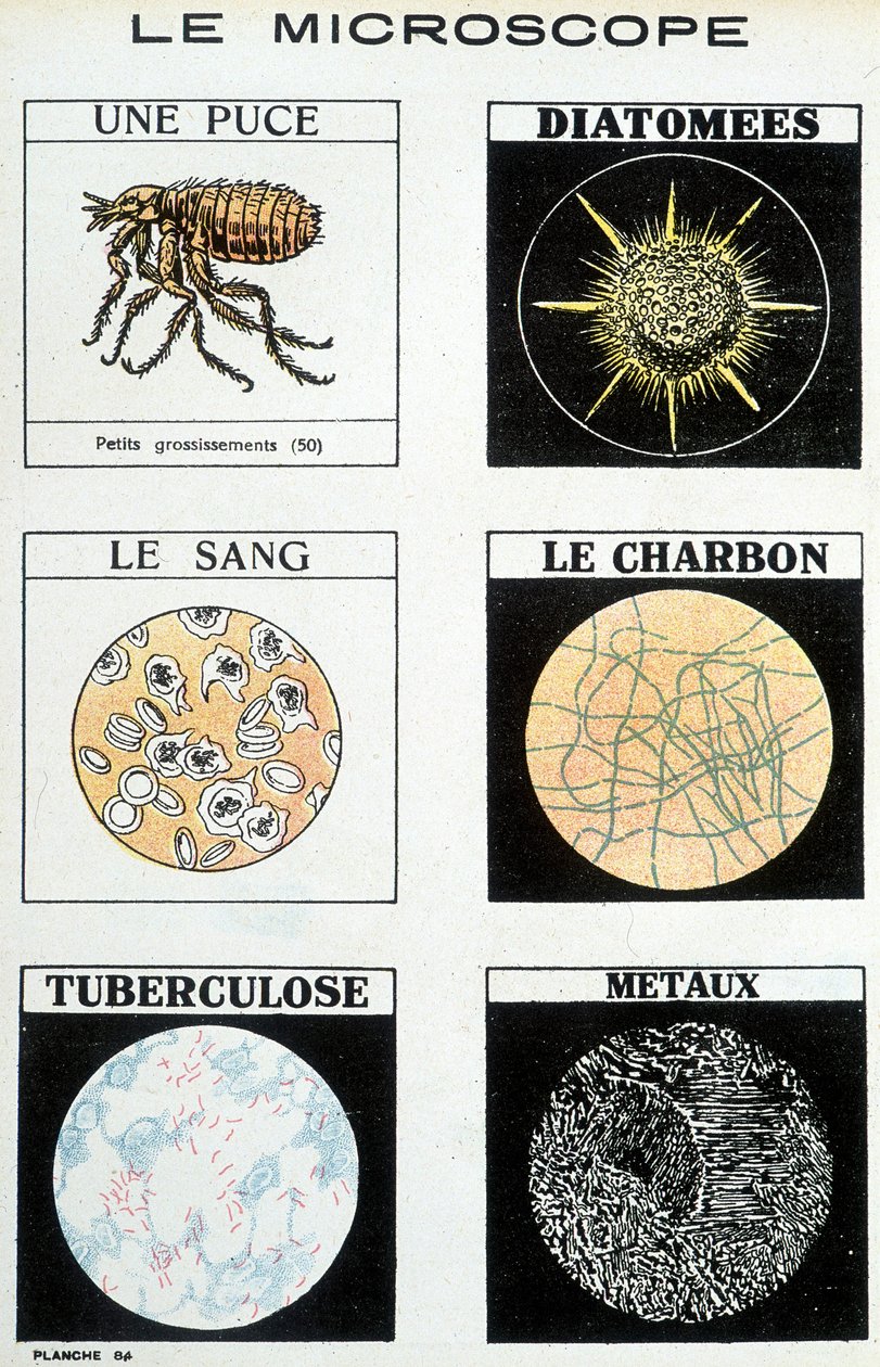 Mikroskopy: chip, okrzemki, krew, węgiel, gruźlica, metale. autorstwa French School