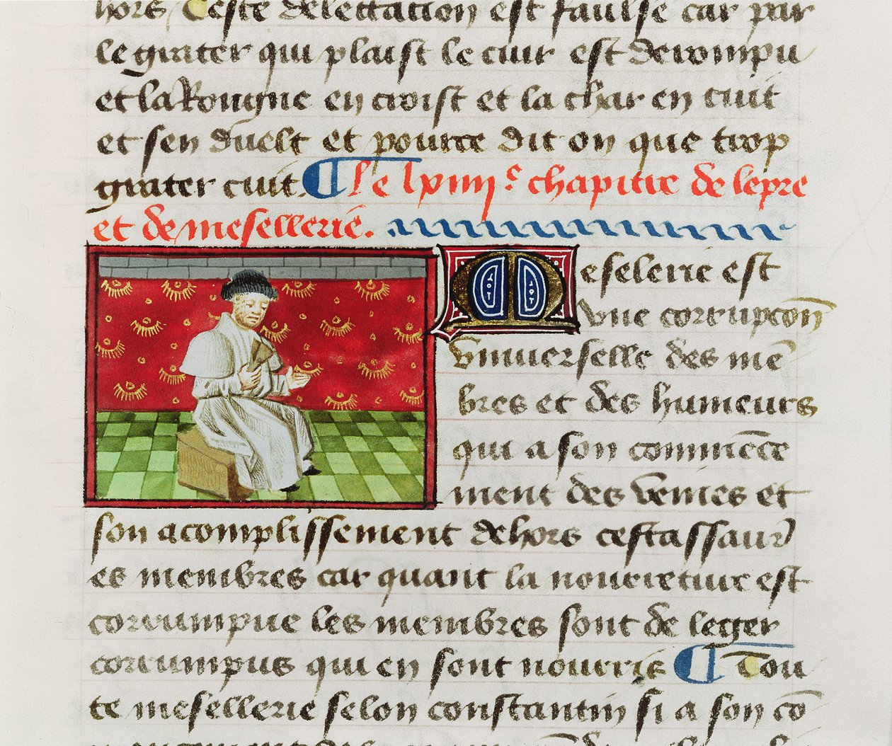 Ms.Fr.22532 Fol.118 Trędowaty, z Księgi właściwości rzeczy Barthelemy