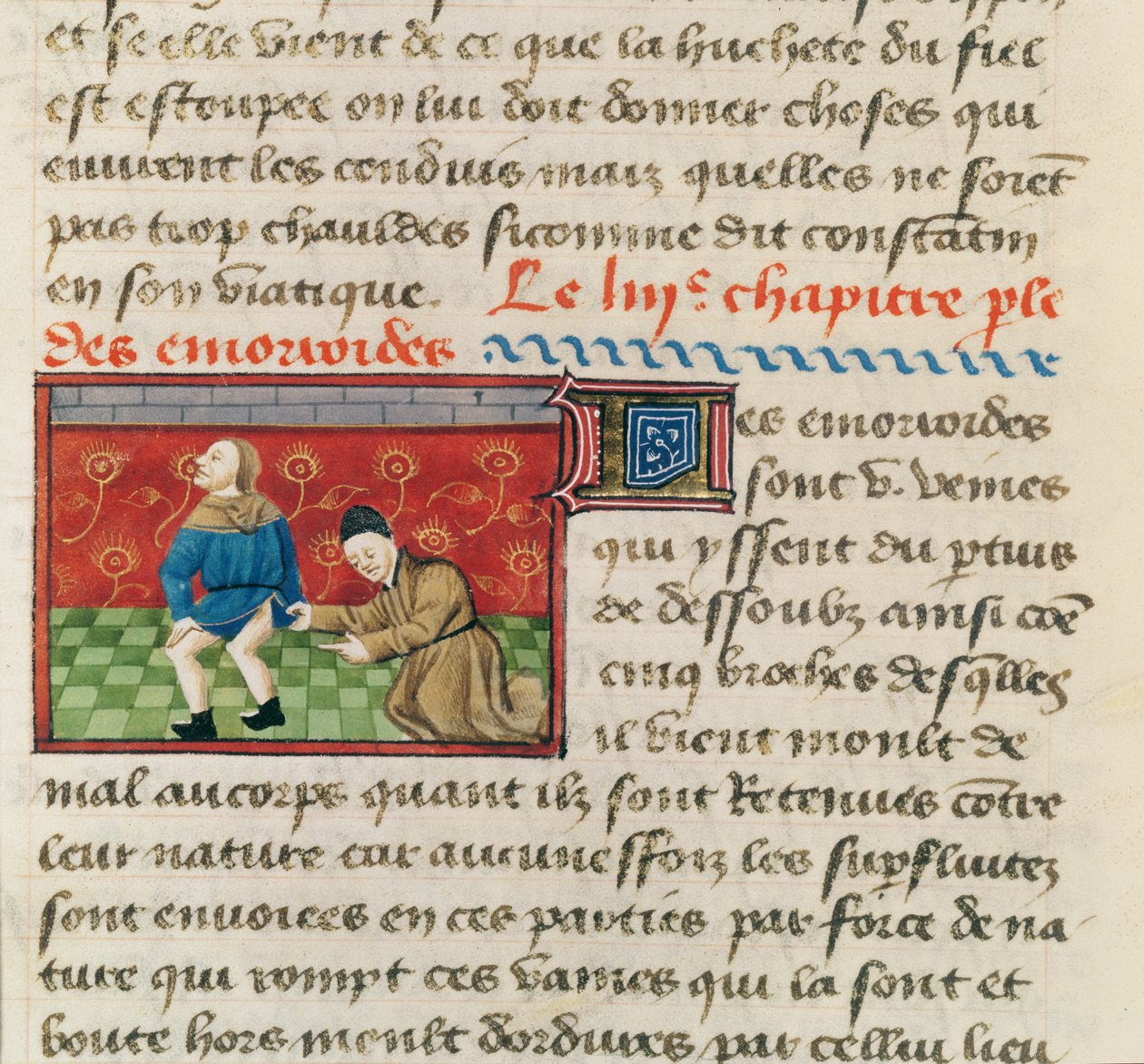 Ms 22532 Badanie pacjenta z hemoroidami, z Le Livre des Proprietes des Choses Barthelemy