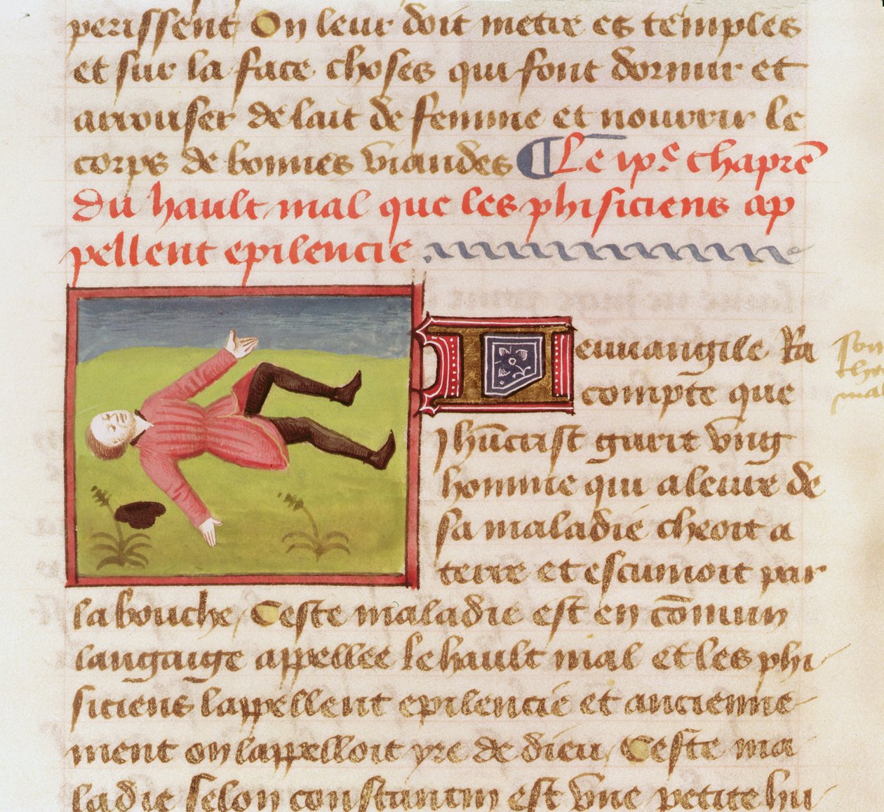 Ms 22532 Pacjent w ataku epilepsji, z Księgi właściwości rzeczy Barthelemy langlais, c. 1410-15 autorstwa French School