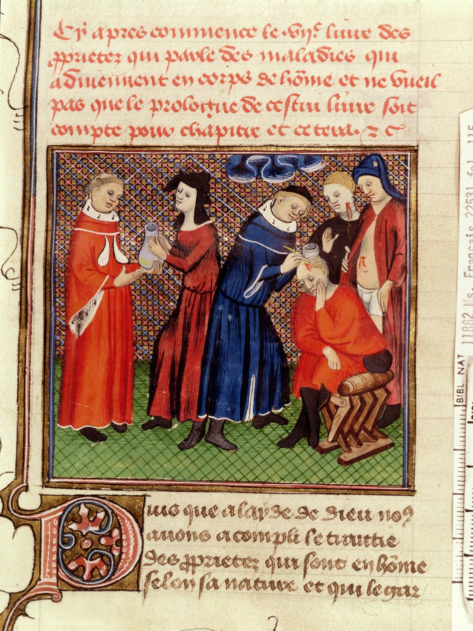 Ms Fr 22531 Fol.115 Badanie moczu i gojenie ran, z Le Livre des Proprietes des Choses Barthelemy